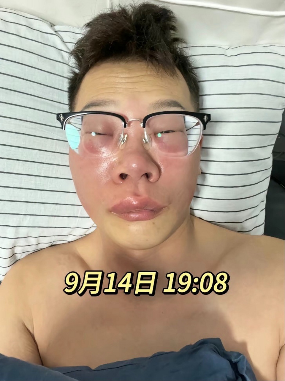 这个习惯就是抠鼻子