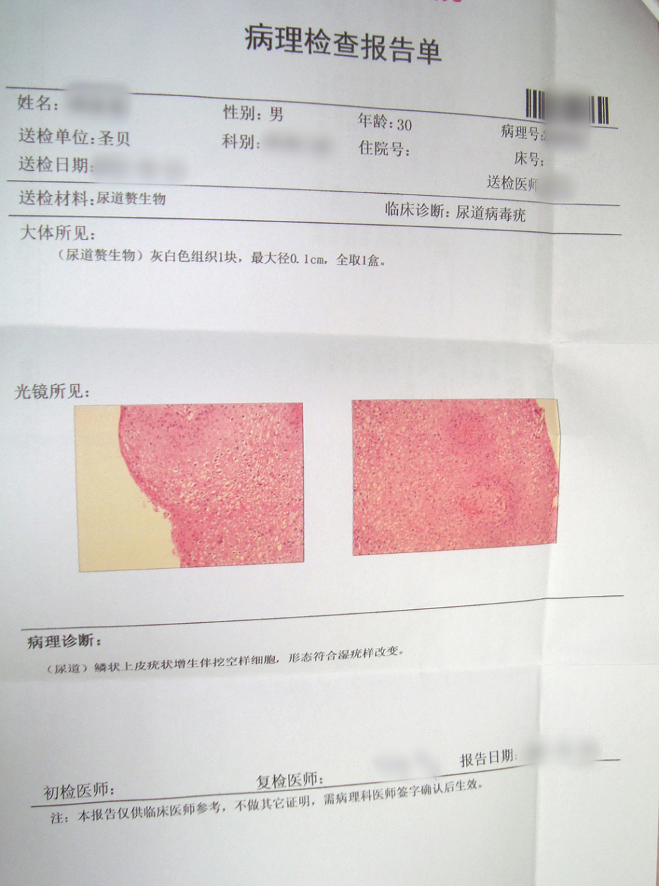 蛋皮毛囊疙瘩图片