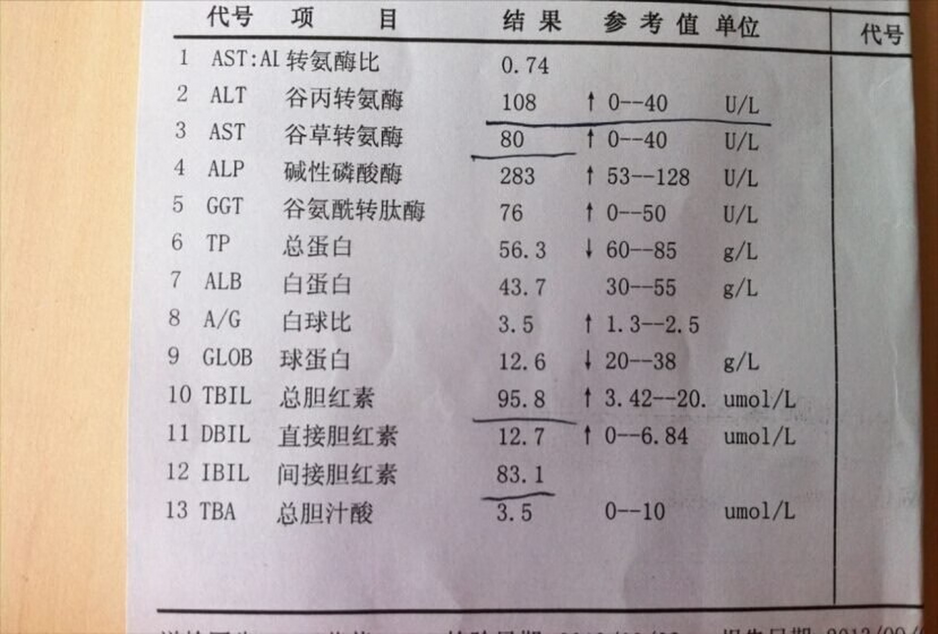 肝功能正常化验单图片