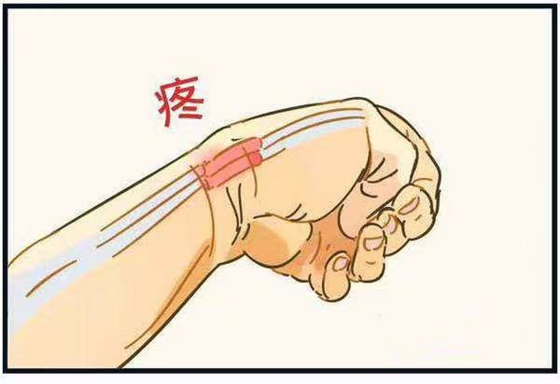 开始的时候右手食指有肿胀的情况,但是当时我没有管