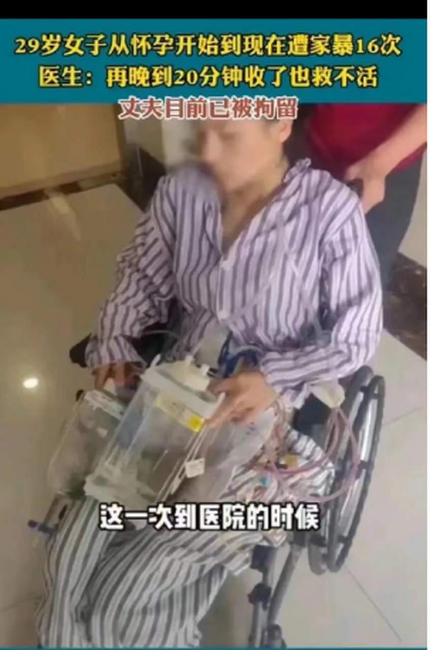 这一次到医院时,医生说她已经没有脉搏了,如果再晚