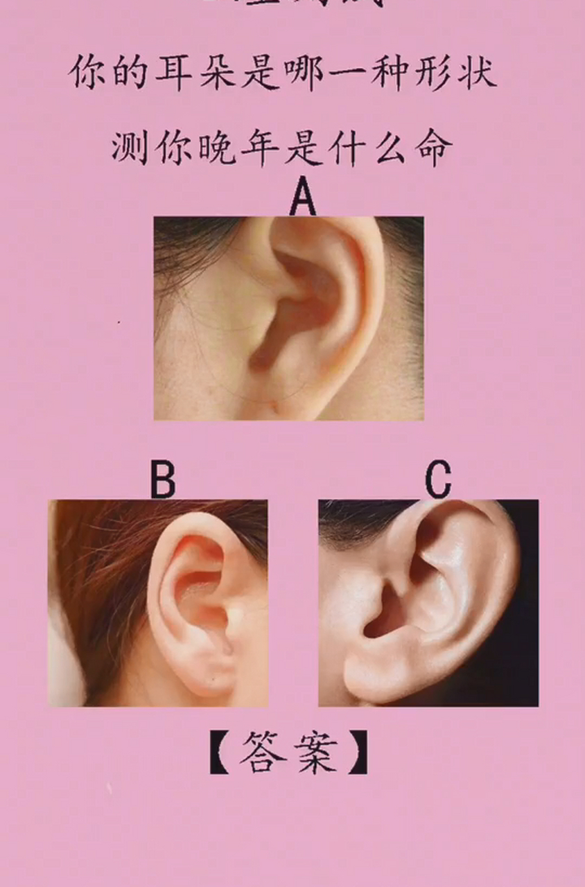 你的耳朵是哪一种形状 测你晚年是什么命