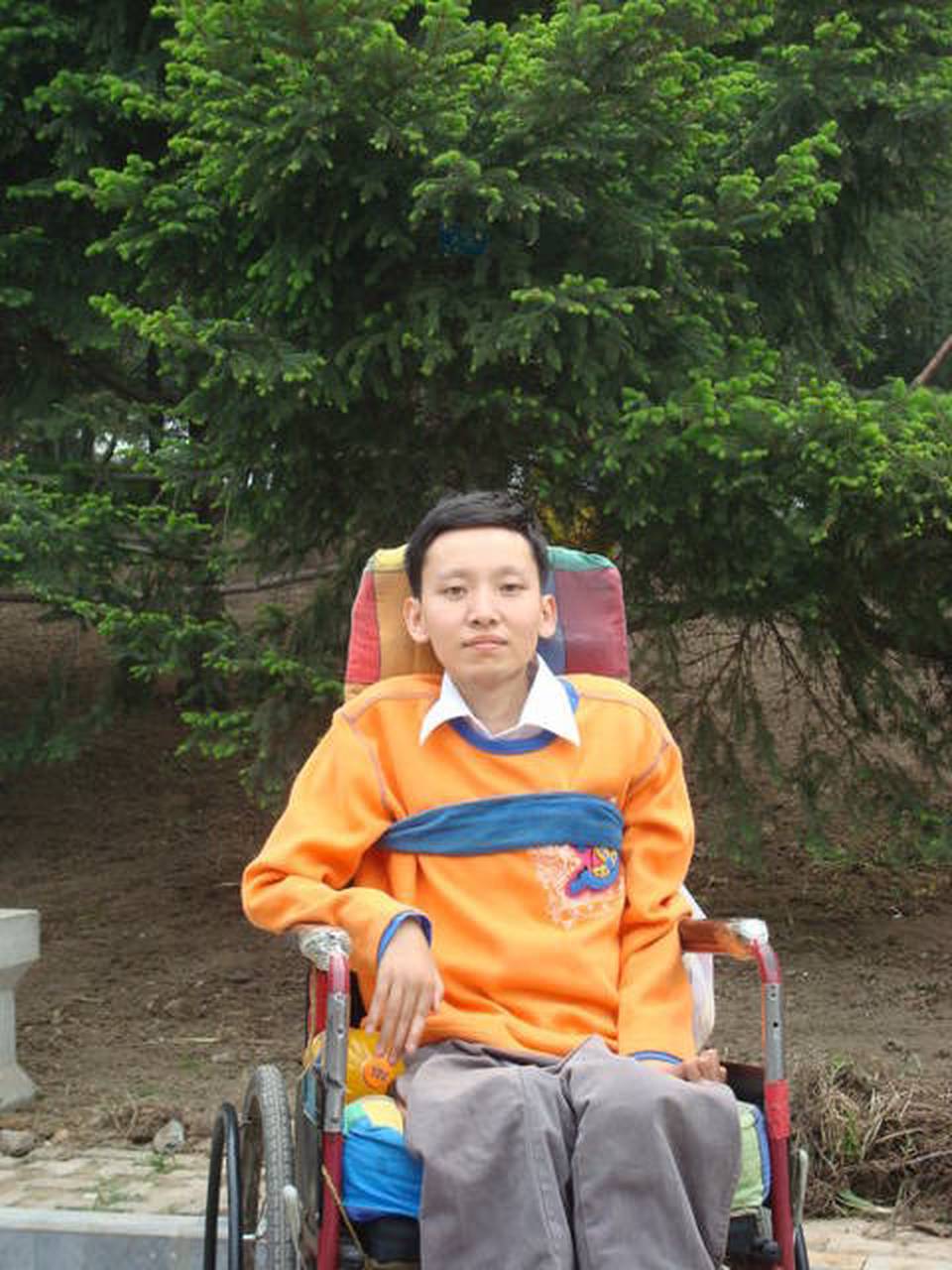 肌营养不良能活多久?