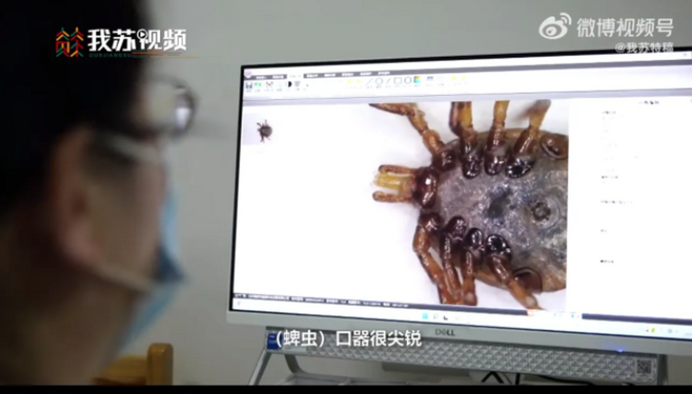 蜱虫,又叫壁虱,也就是我们常说的草爬子,狗豆子,红褐色,长卵圆形.