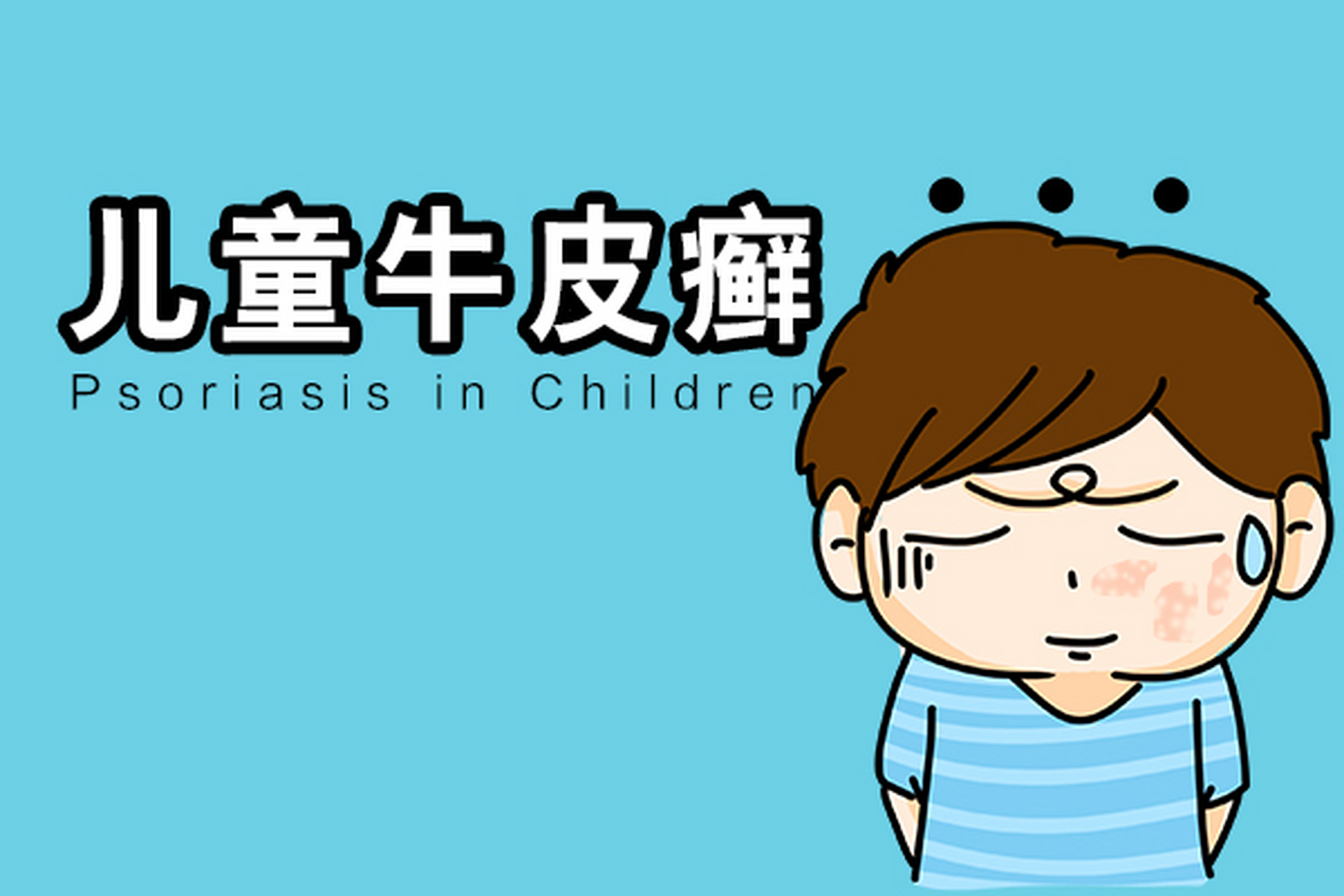 儿童银屑病,正确认识 尽早治疗很重要         我是皮肤科医生何英