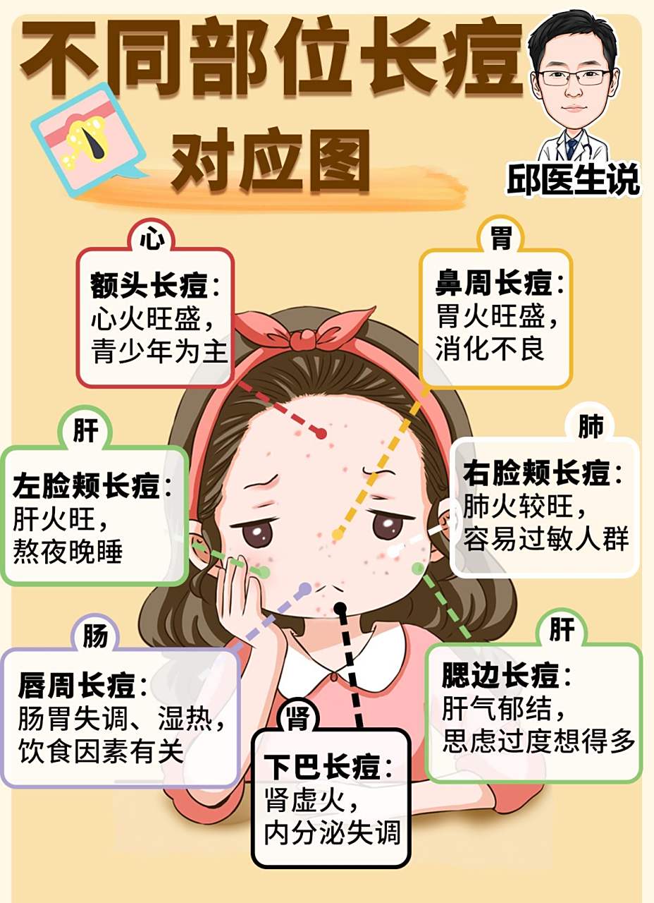长痘痘位置不同,反映身体脏腑的健康状态也不同!