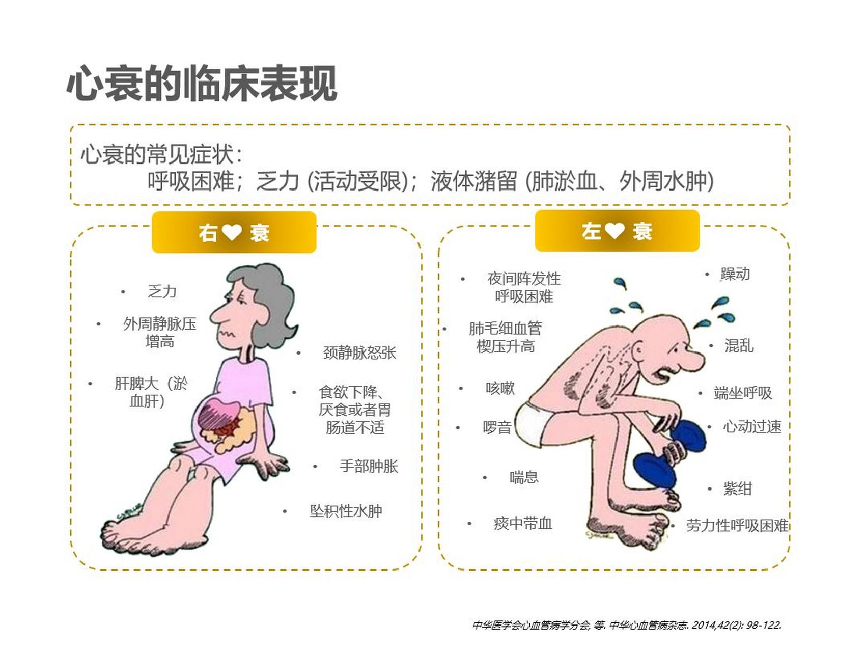 心力衰竭的病因及其对患者生活质量的影响   心力衰竭