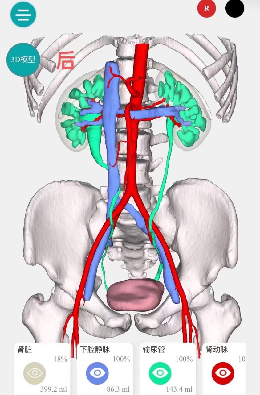 下腔静脉阻塞图片