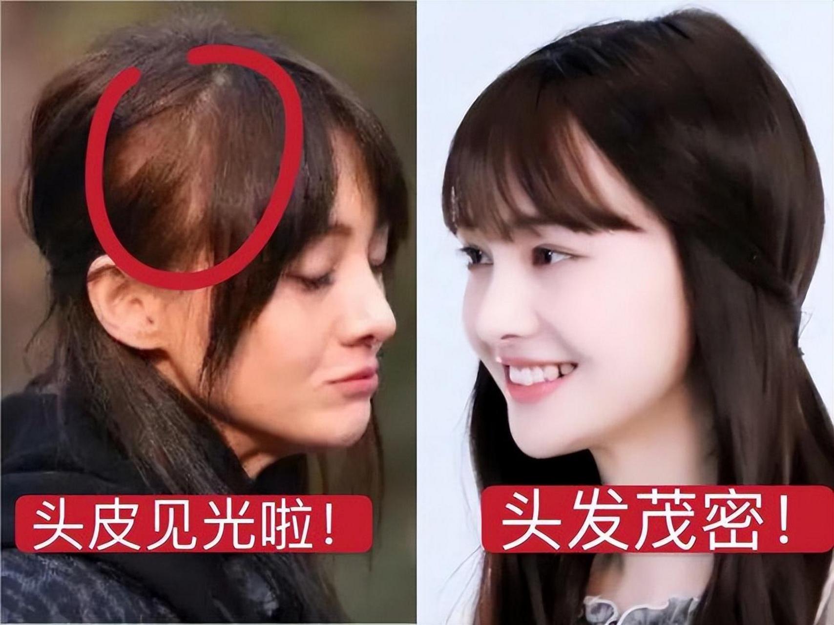 郑爽海外近照曝光!身体发福严重,疑似秃顶!网友:这也太丑了!