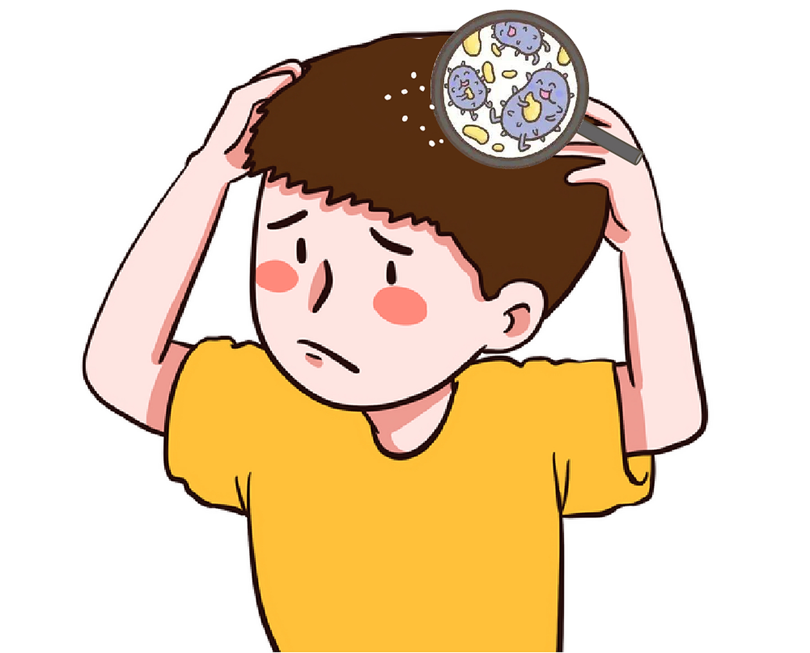 7615雪花般的头皮屑是因为它?请警惕,这种真菌几乎人人都有!