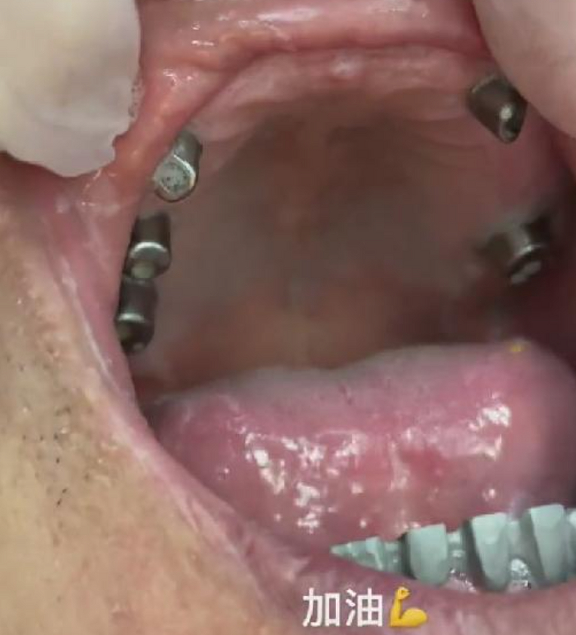 这下确定是铁齿钢牙