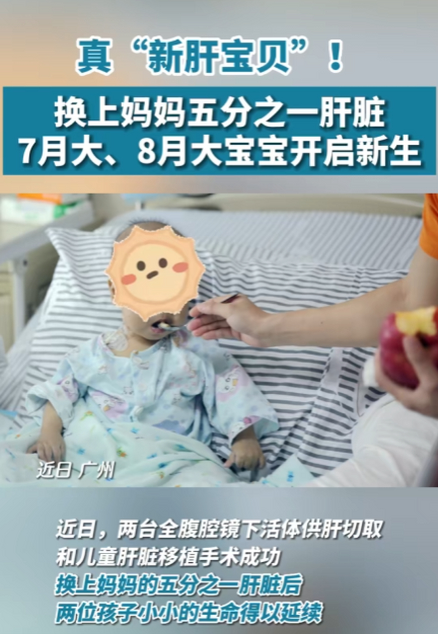 真"新肝宝贝"!换上妈妈五分之一肝脏,7月大,8月大宝宝开启新生