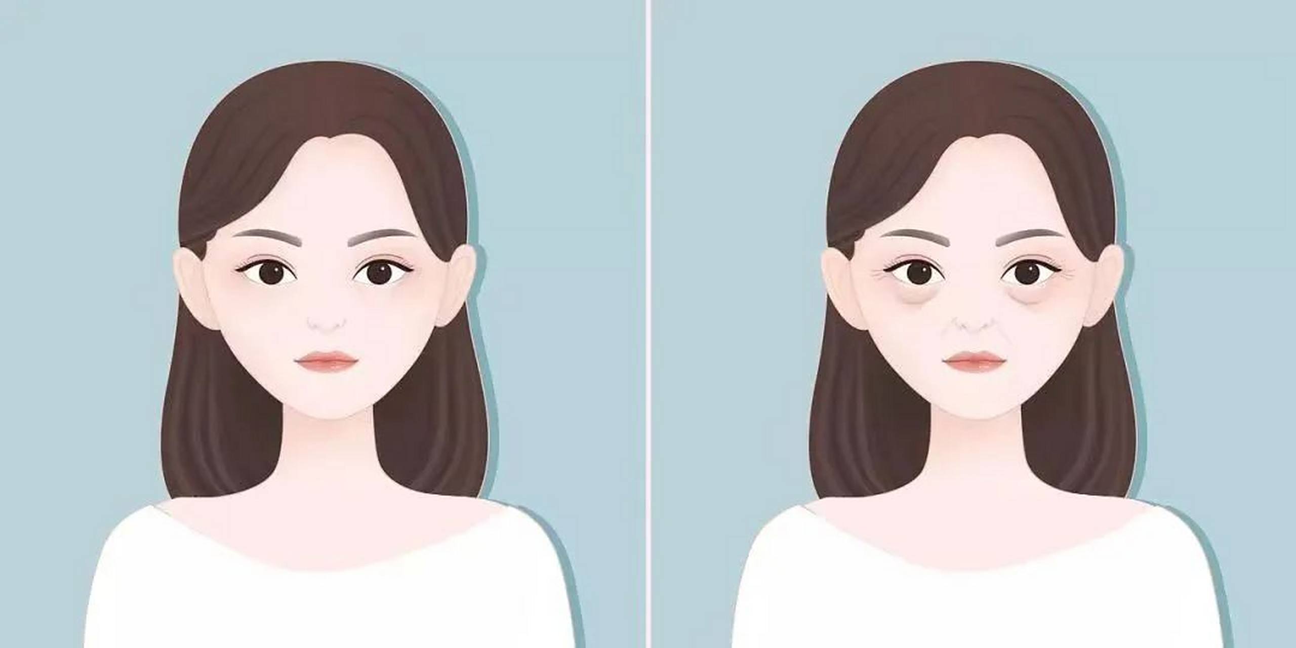 眼袋小课堂#   眼袋的杀伤力有多大?