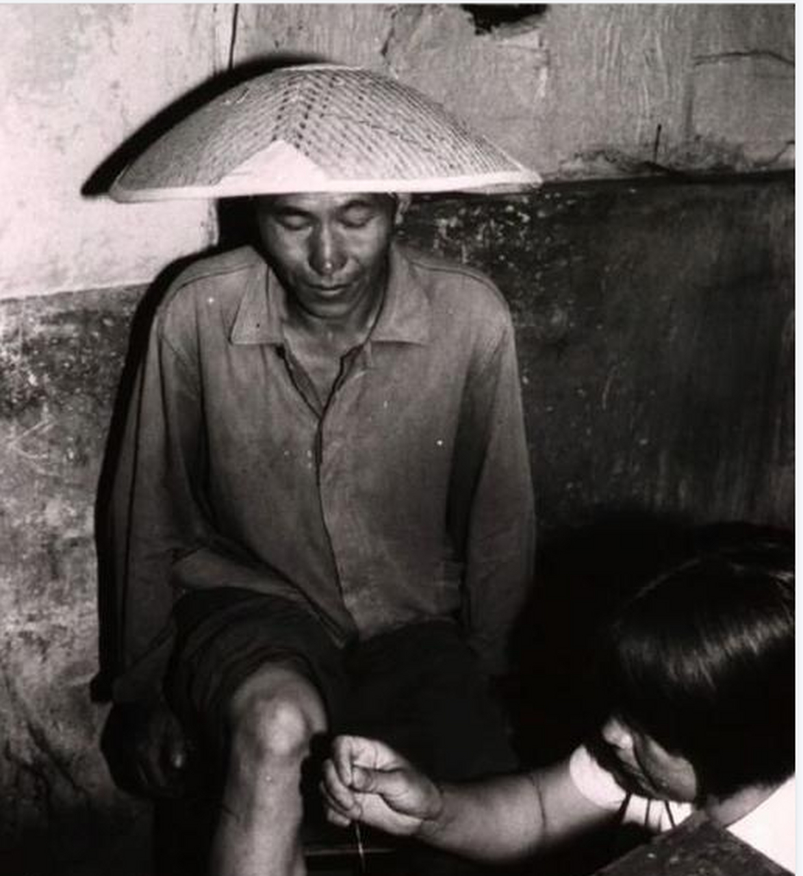 上世纪70年代西南偏僻的小山村里赤脚医生正在给一位老人腿部扎针
