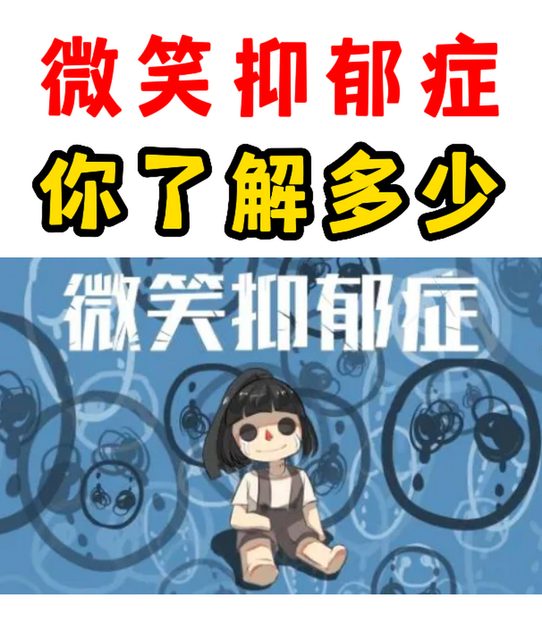 微笑抑郁症你了解多少?