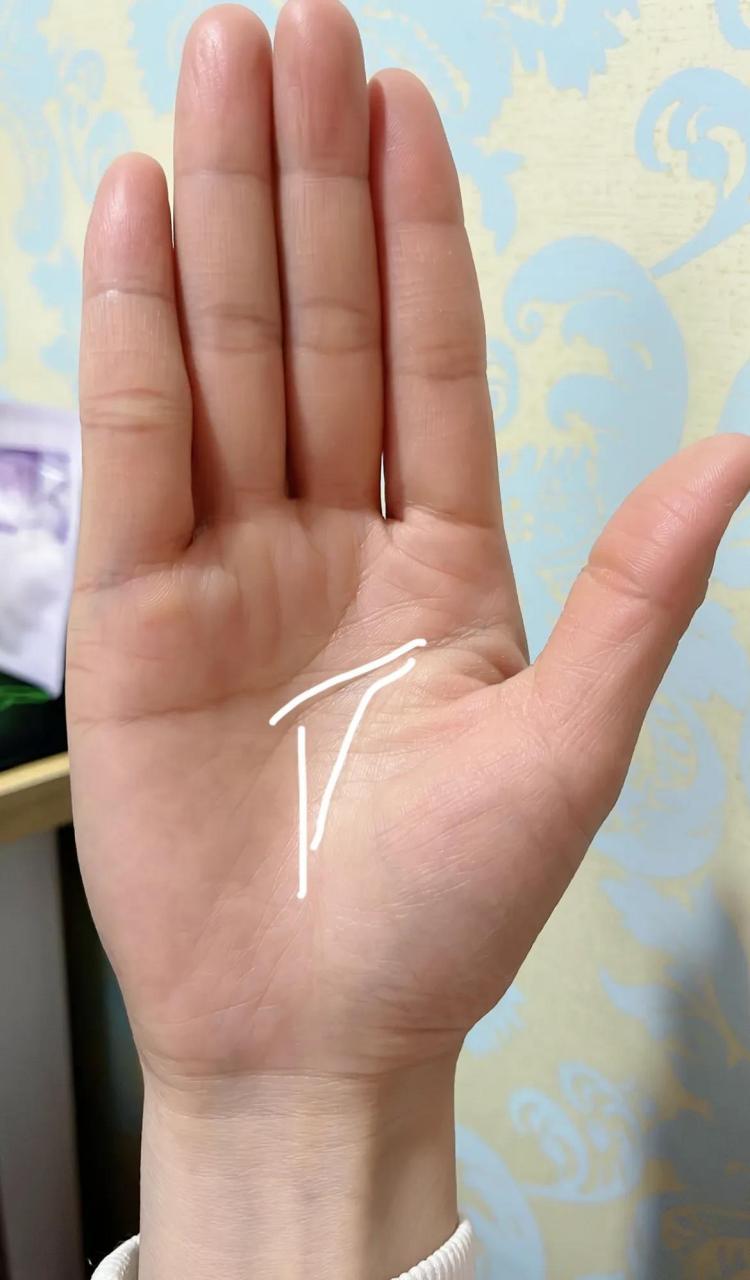 发现我这种带三角形的手纹真不多,是个等腰三角形[偷笑]