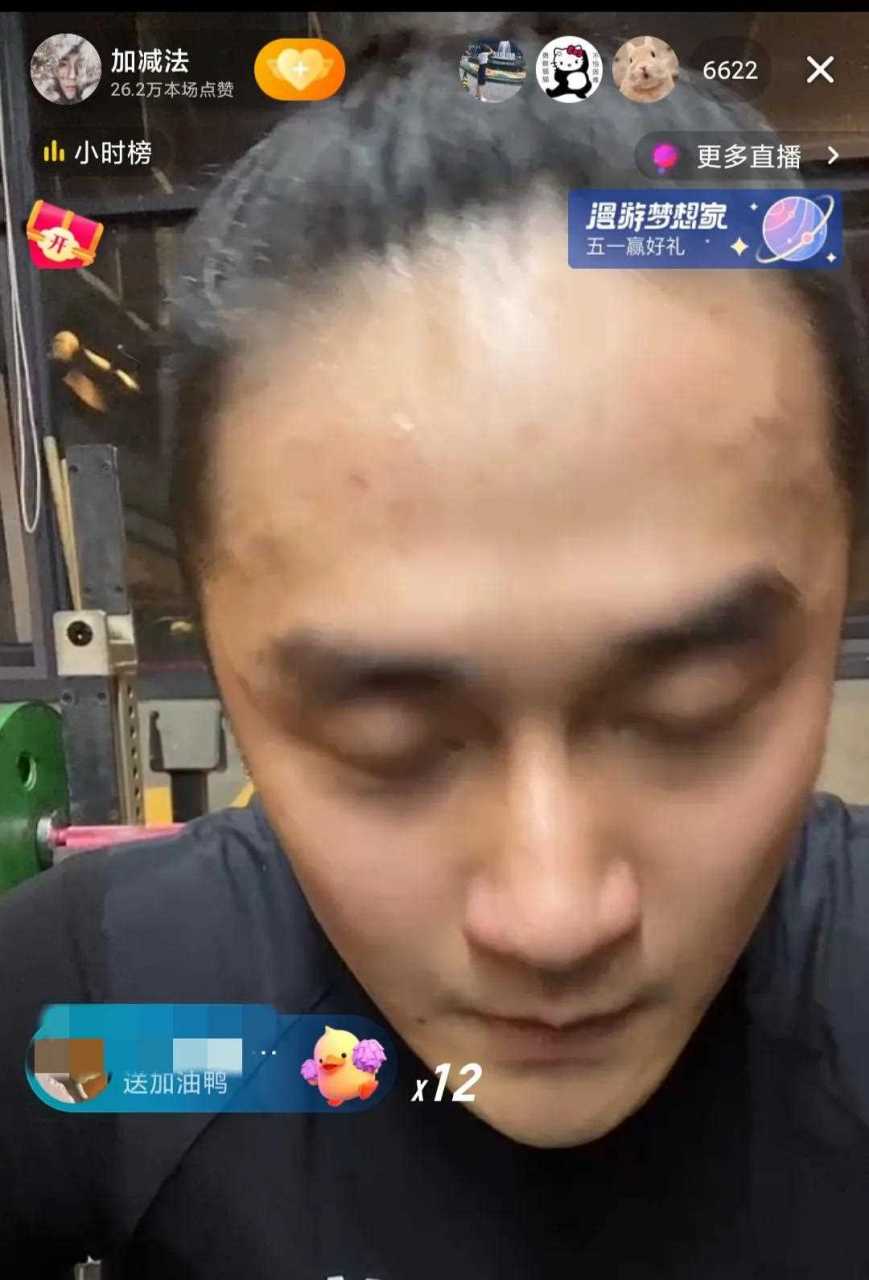 蒋劲夫想要复出 首先要考虑的是去植发 这发际线有点高了