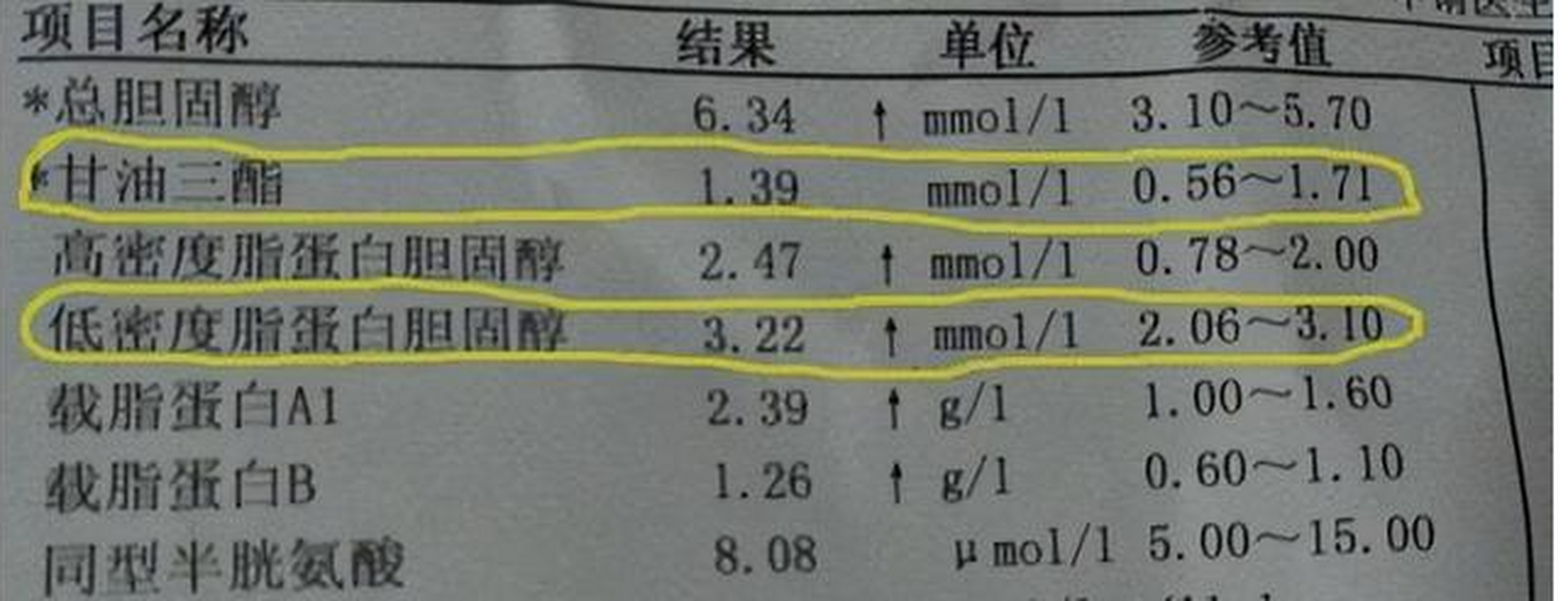 脂蛋白(a)高是怎么回事图片