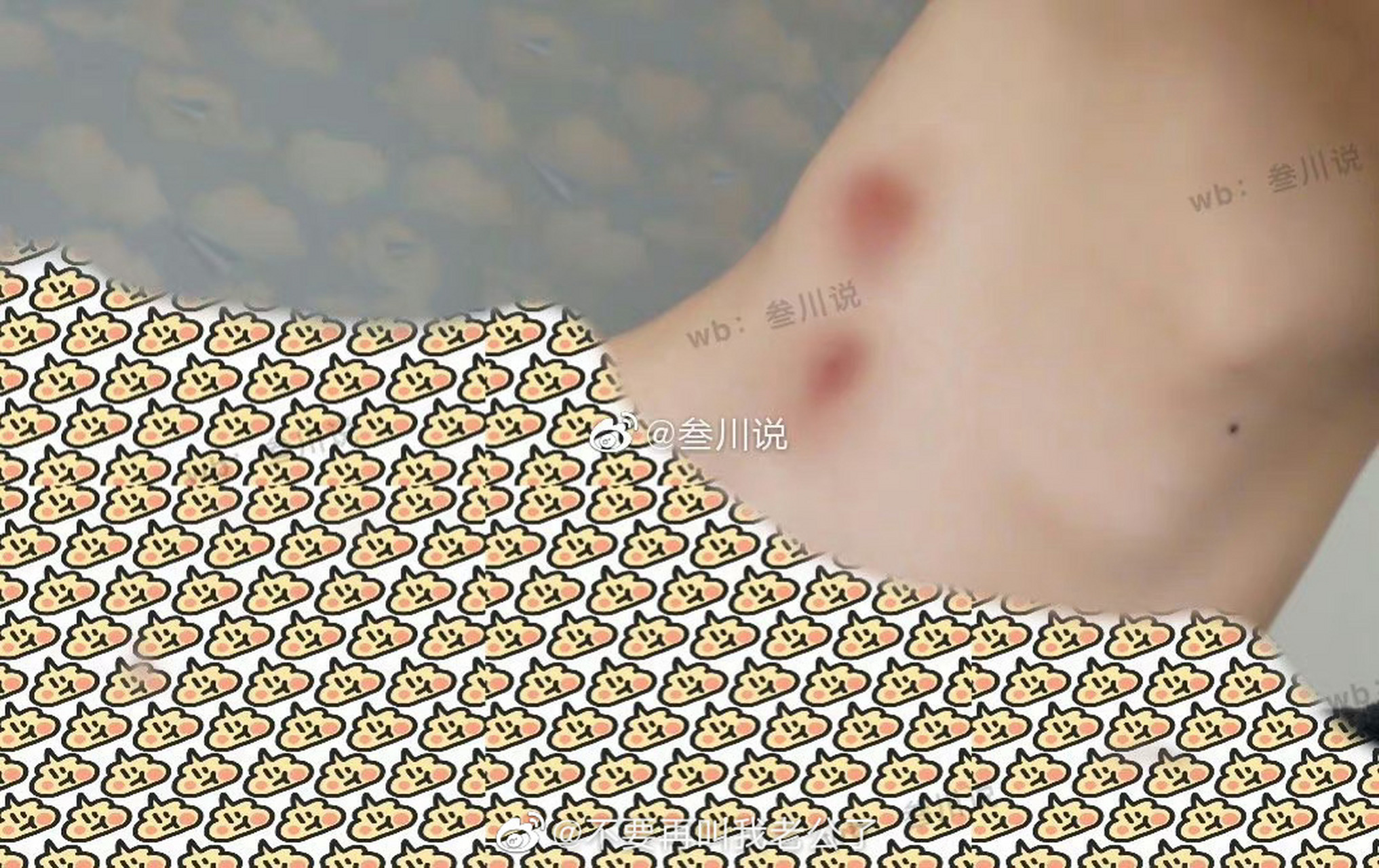 女朋友在我脖子上种了草莓,回家爸妈看见之后要我和女朋友分手.