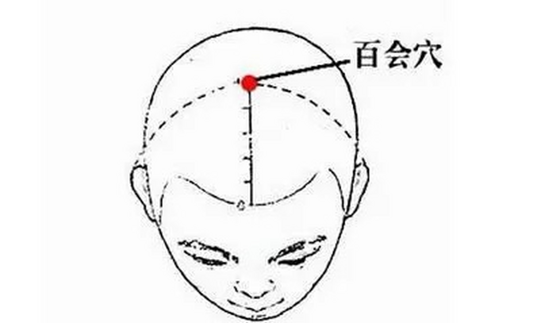 脑供血不足,经常头昏脑涨,多按这两个穴位会有改善 1,百会穴:在头部