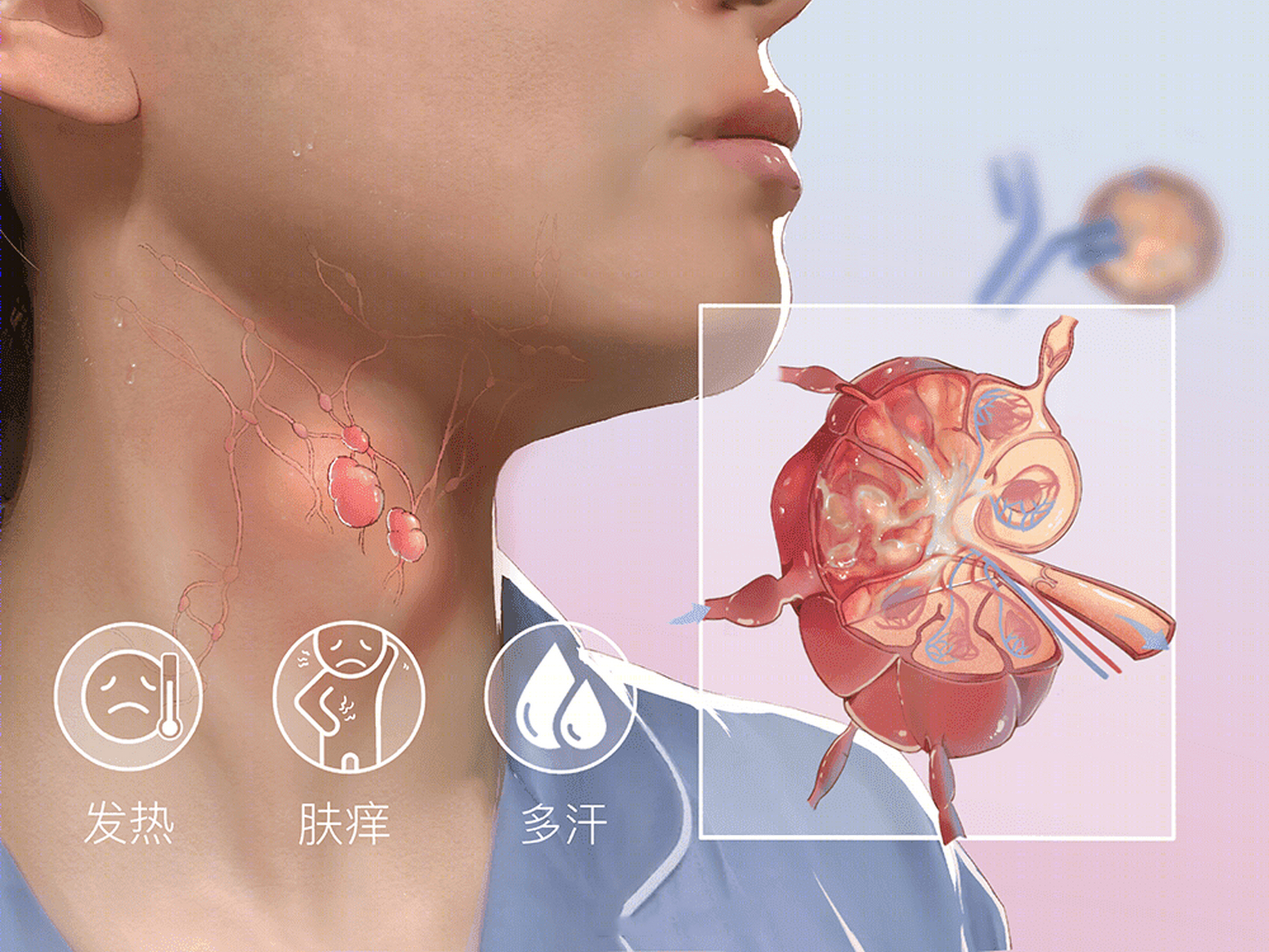 我的门诊故事#【淋巴瘤术后淋巴结转移,中医软坚散结,扶助中气,临床