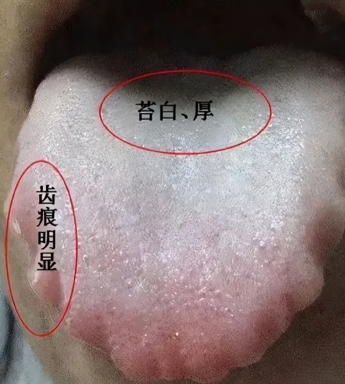 湿气重,舌苔白腻,就不能纯补.