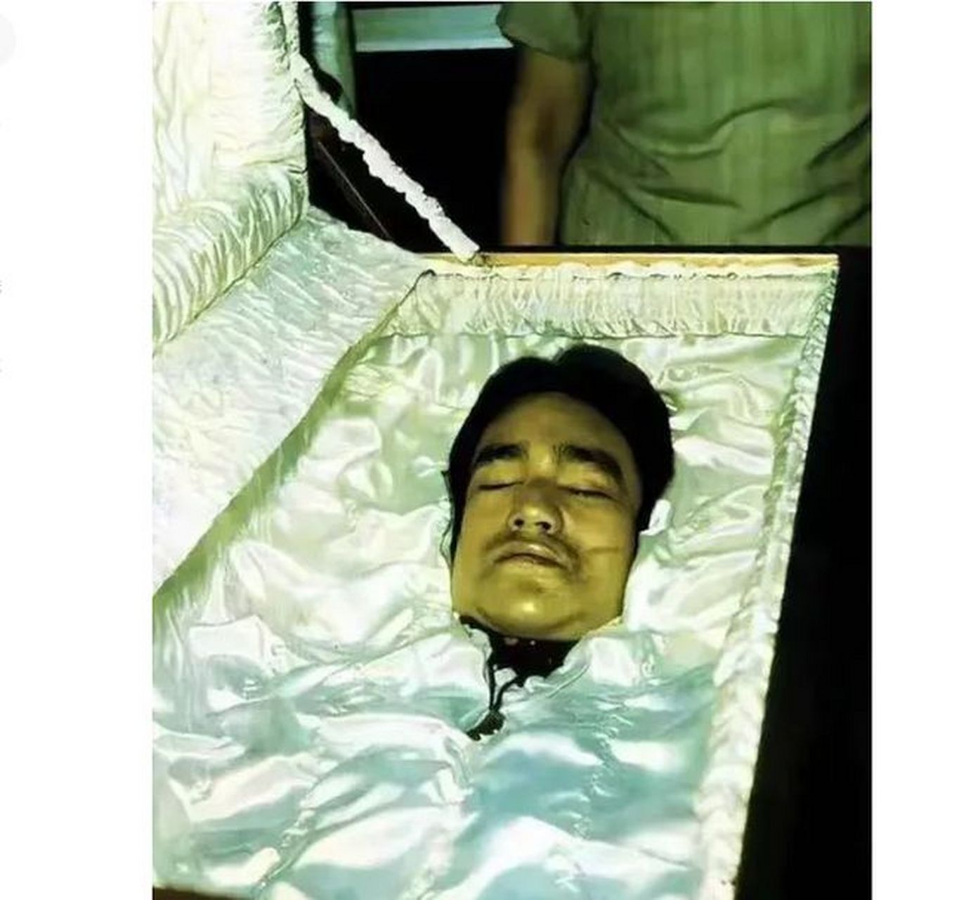 我不知道这是不是伤疤.