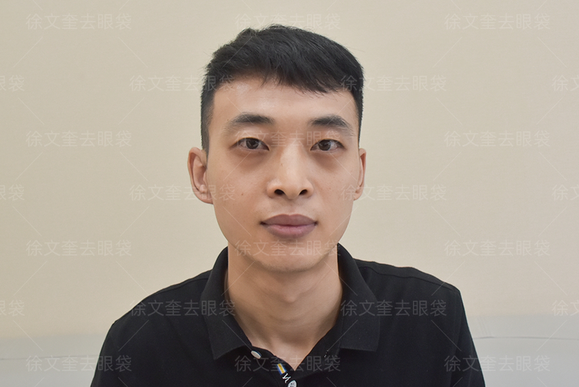 整个人看起来疲惫憔悴,由于平常工作比较忙碌,更倾向于做近似无痕的
