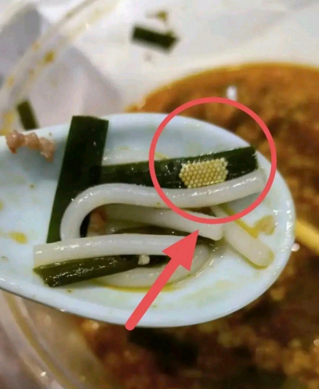 吃海带也能吃到虫卵