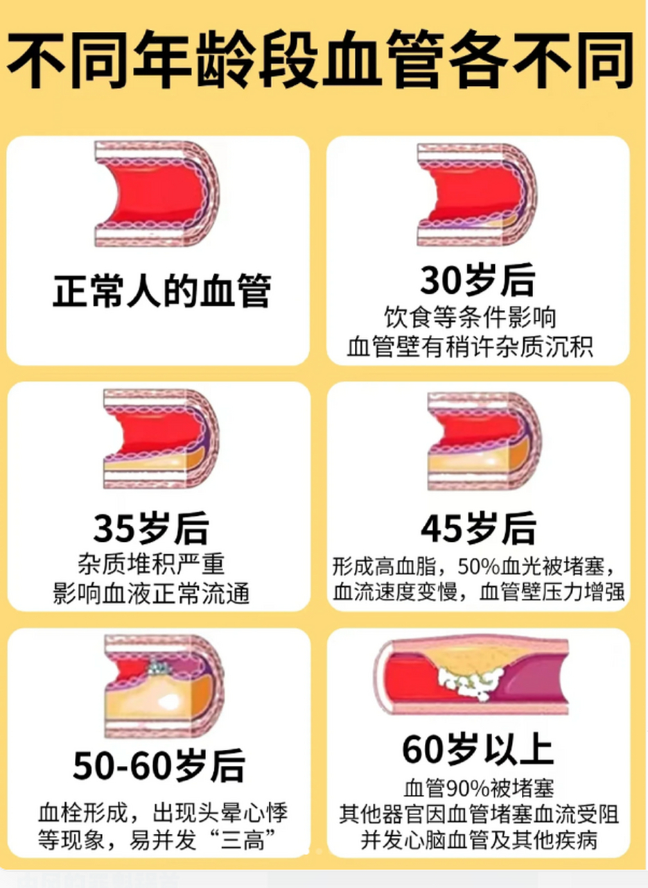 日常生活中你是怎么一点一点让你的血管堵塞的?