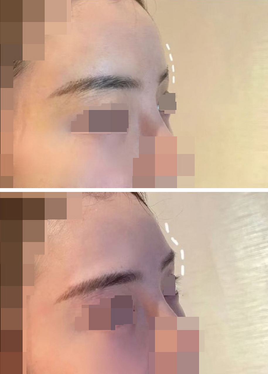 有些姑娘私信老路:我的额头挺饱满的,正常来说应该看着很立体,可是不