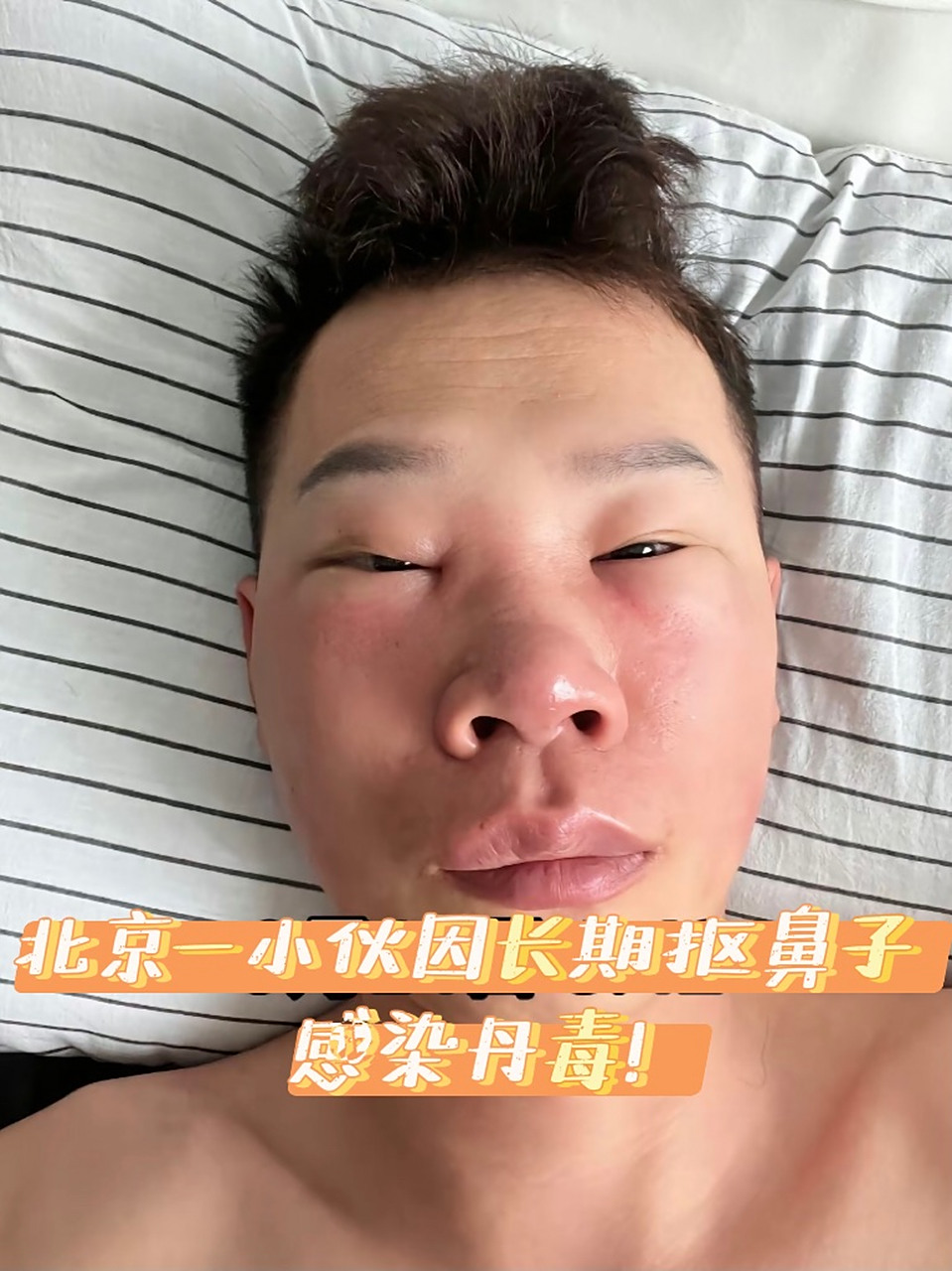 这个习惯就是抠鼻子