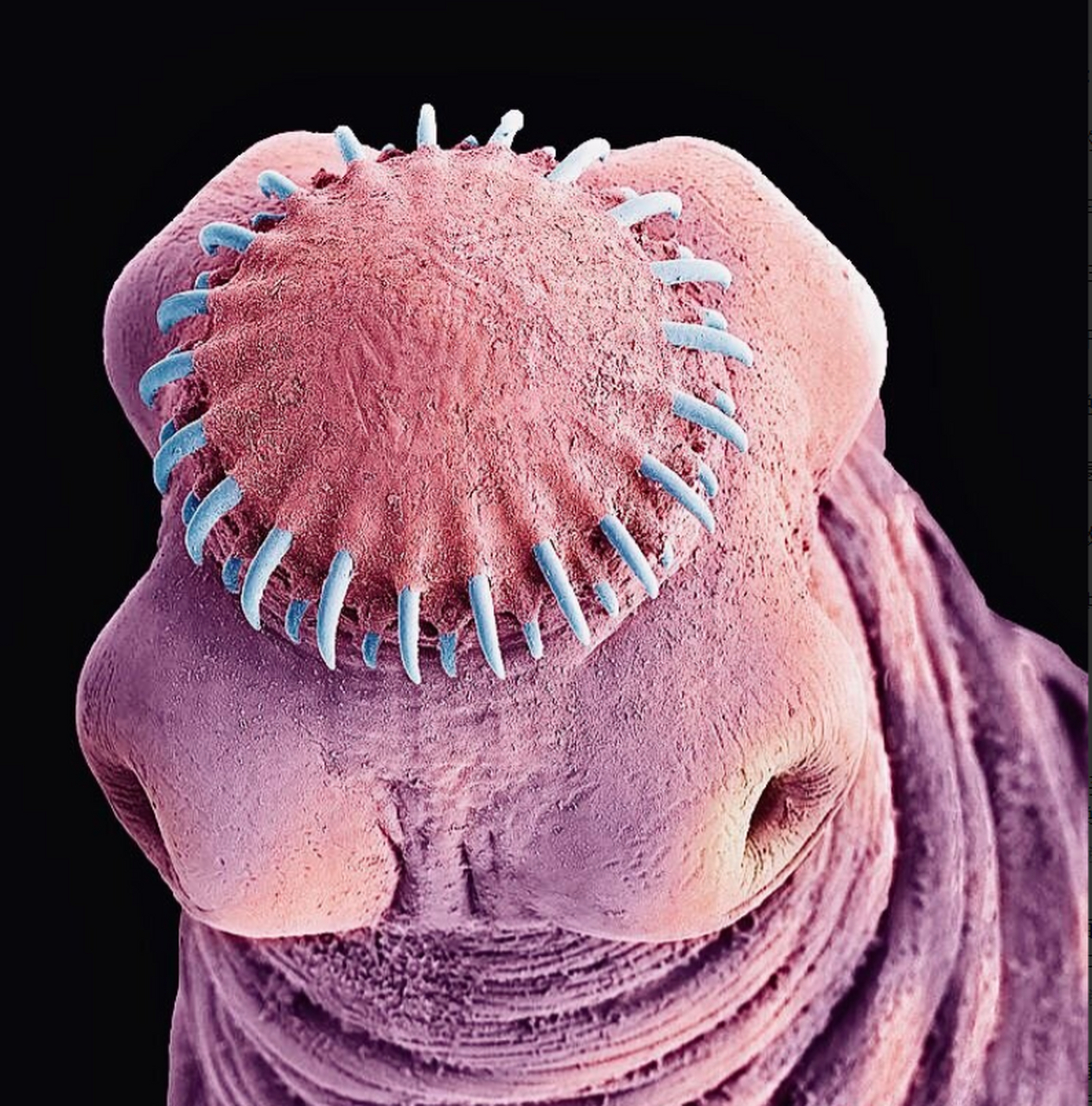 通过电子显微镜看到的绦虫头,看上去有点恐怖啊!