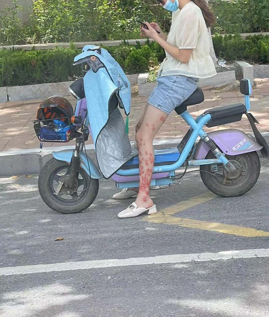 街上偶尔遇见,小姐姐的腿怎么了[大哈]