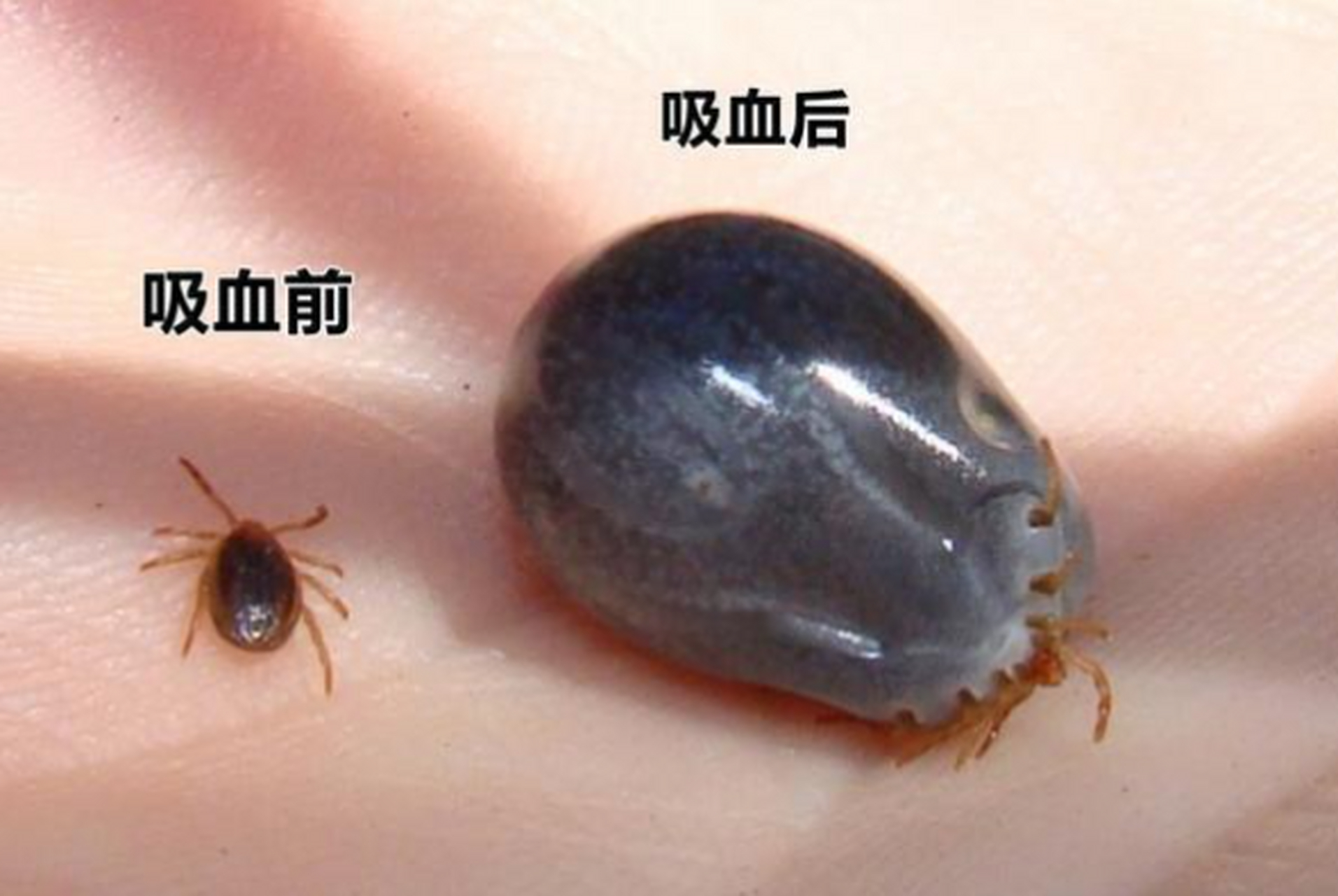 蜱虫的卵长什么样子图片_蜱虫的卵长什么样子图片视频  第2张