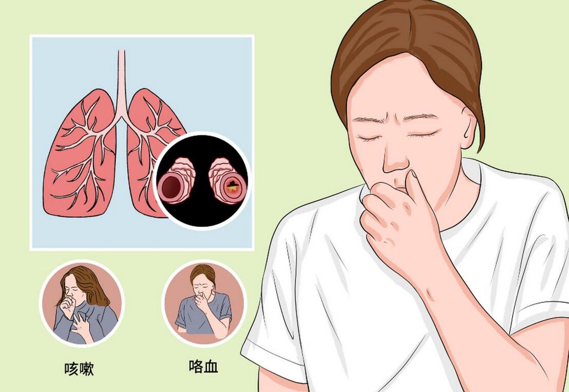 支气管扩张,平时这样保养,身体慢慢的在变好 很多支气管扩张的患者,总