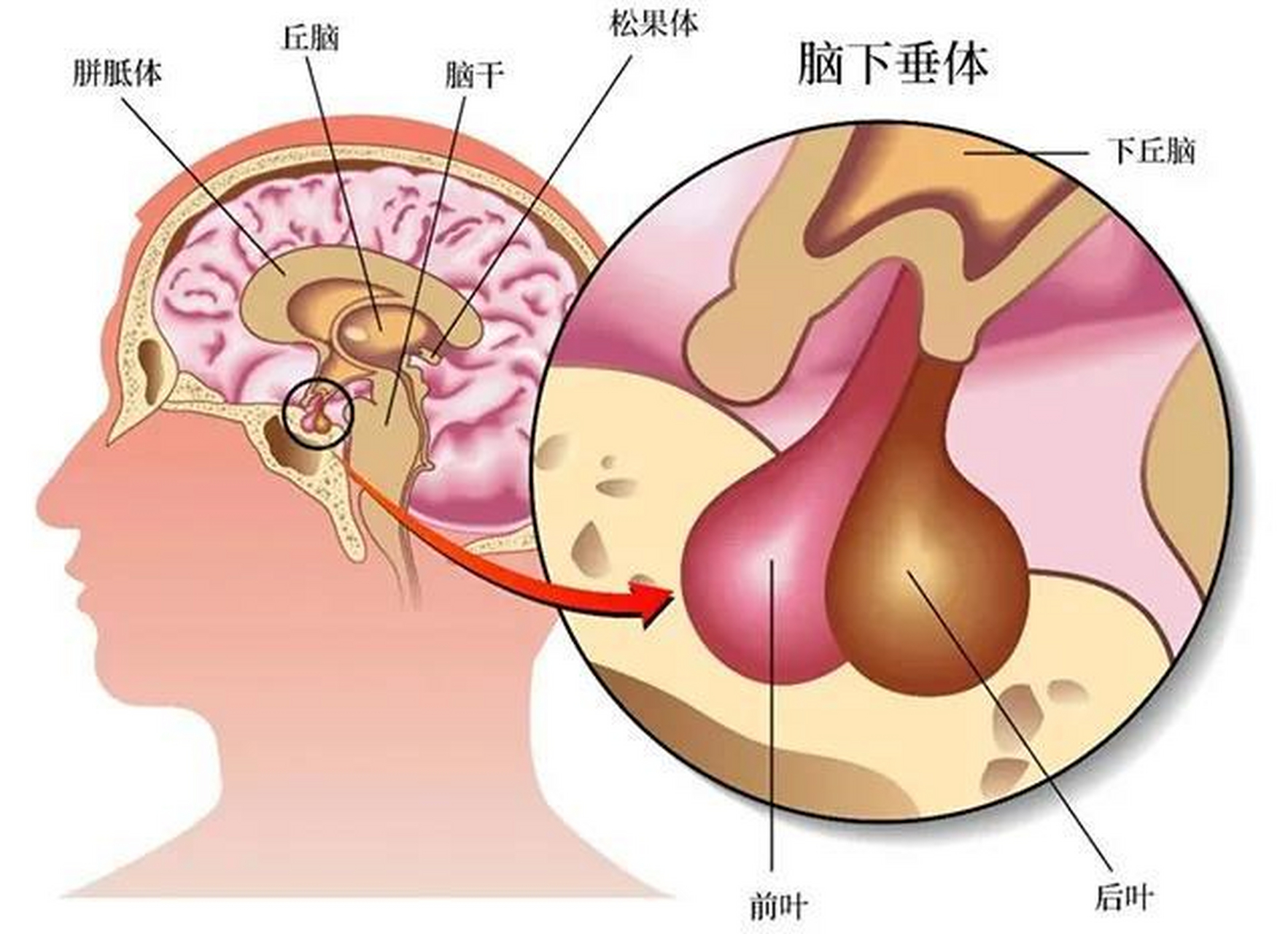 脑垂体瘤图片位置图片