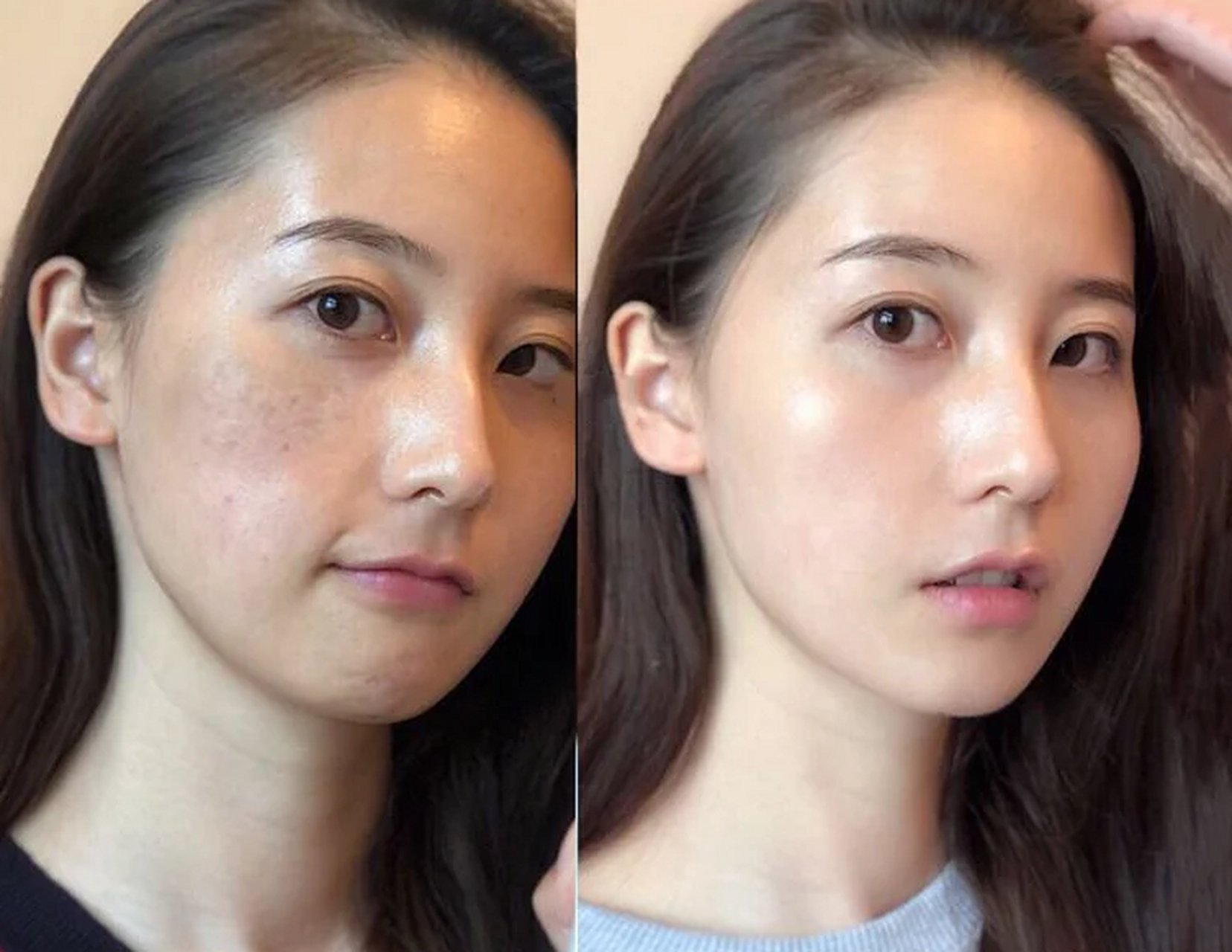 脸上晒斑怎么消除最快速度?