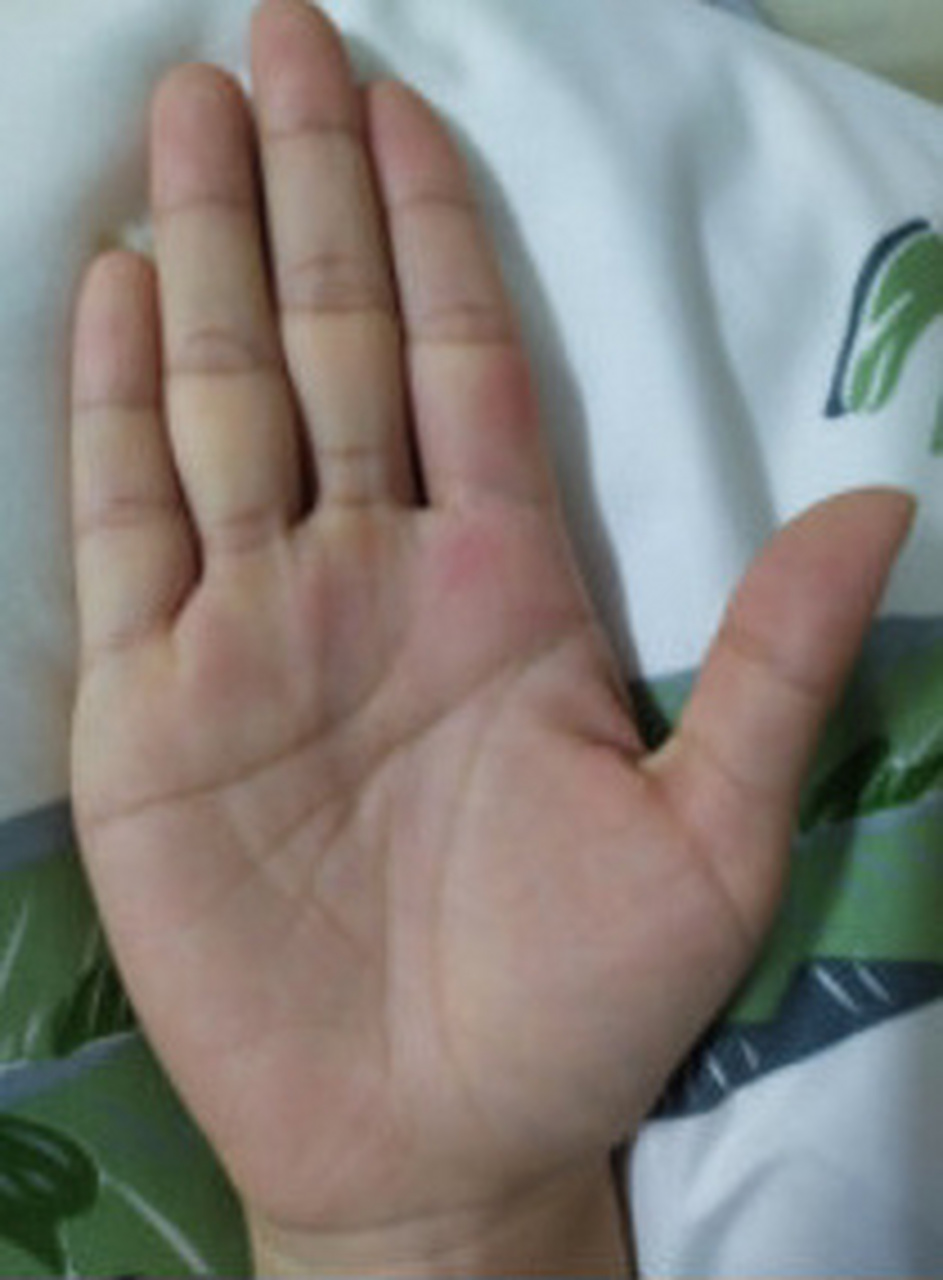 手相分析:  智慧线尾部分叉有竖纹,性格不稳定犹豫不决,生活中口是心