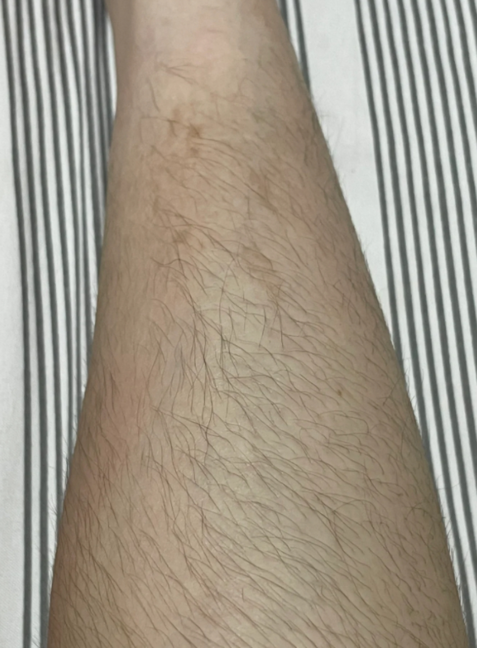 为什么腿毛多还长百科在线 为什么腿毛多还长百科在线