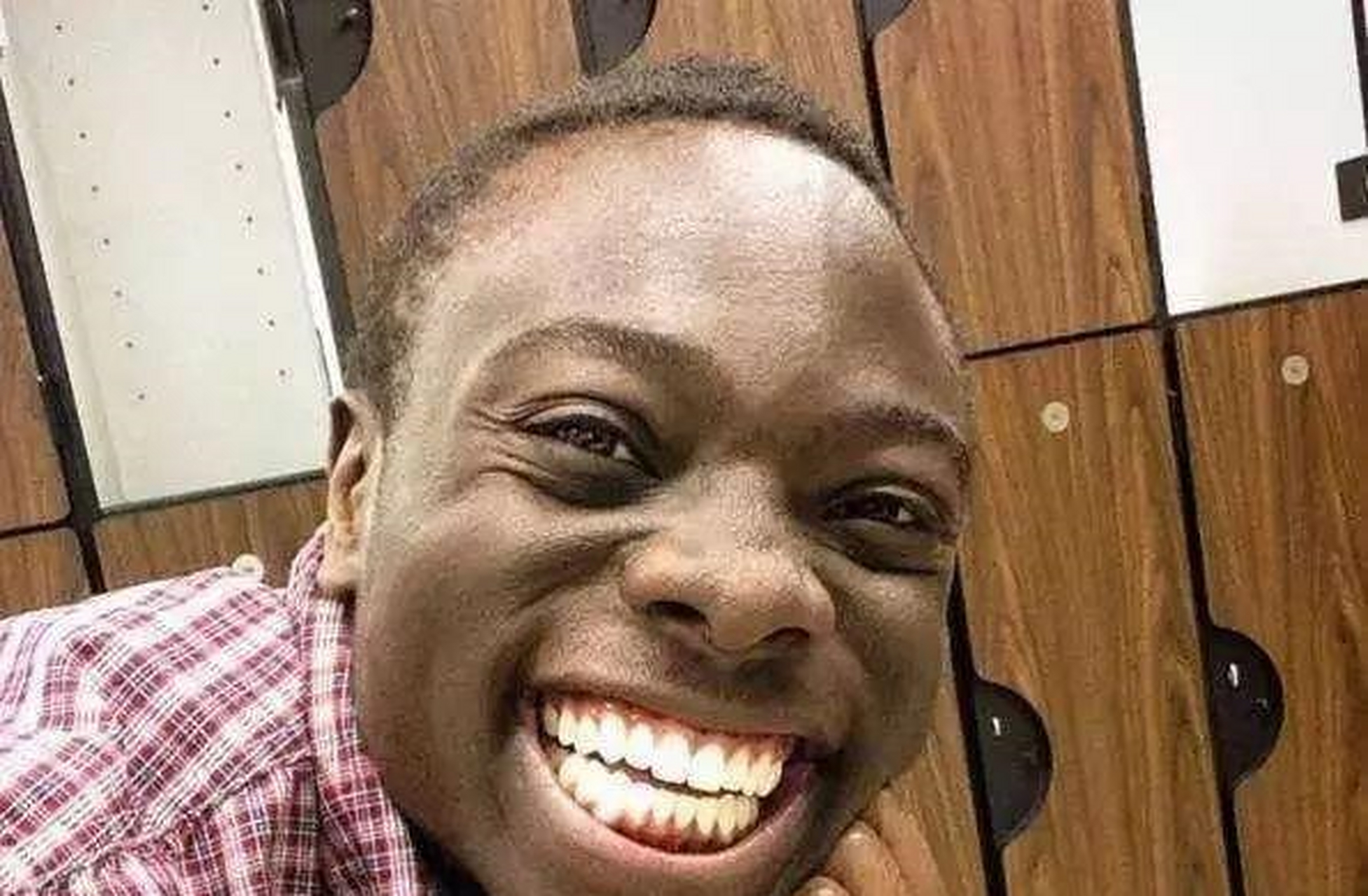 为何非洲人虽然黑但是牙齿很白?