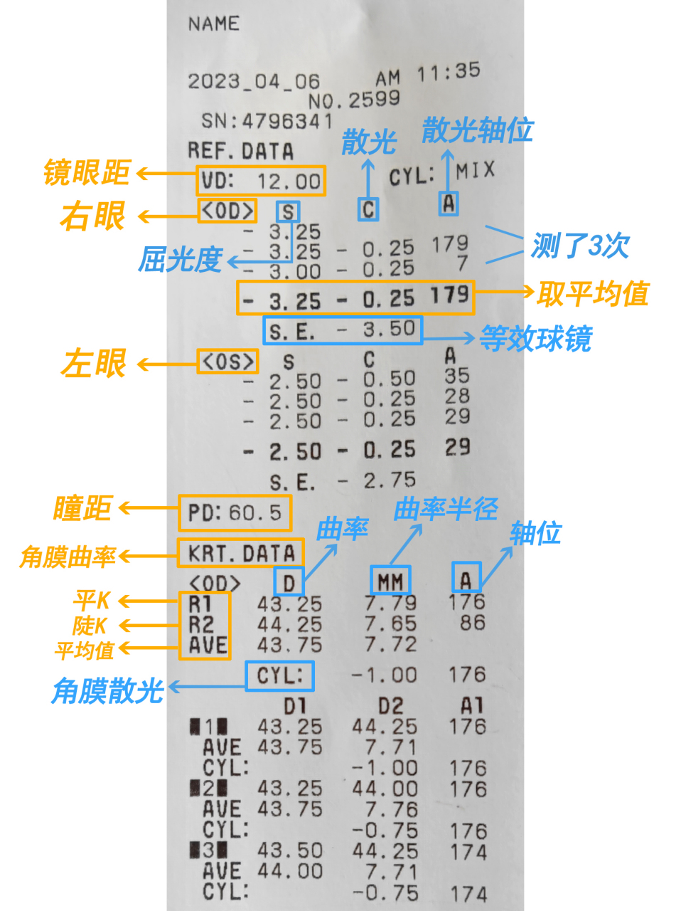 视力检查单怎么看?