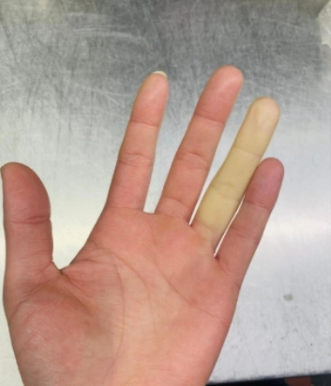 我这手指头是咋了啊,中毒了吗?