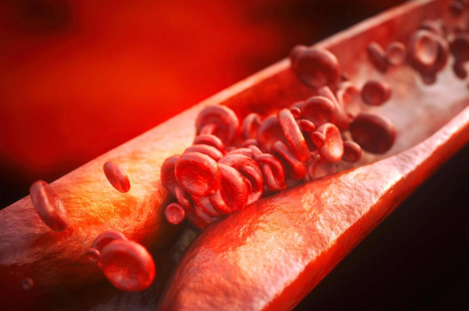 这味中药,是活血化瘀的小帮手,搭配的好还能缓解血管疾病 今天给大家