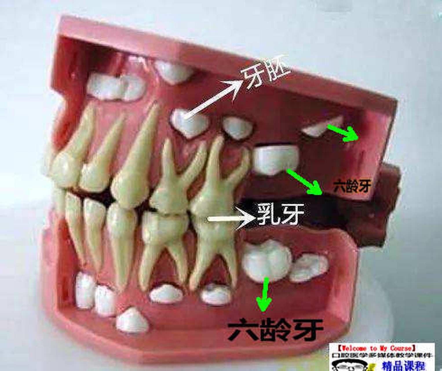 六龄齿萌出过程图图片