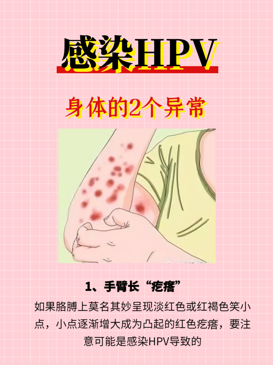 手臂和脚底长这种"疙瘩"可能感染上了hpv,可以对照检查看看