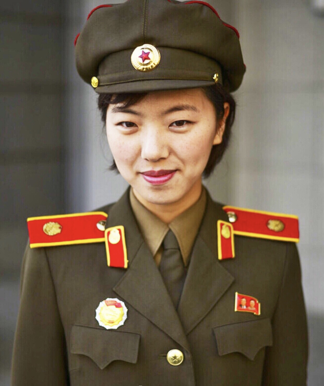 金佑景(女,26岁),因患胃病,胃切除了三分之四.