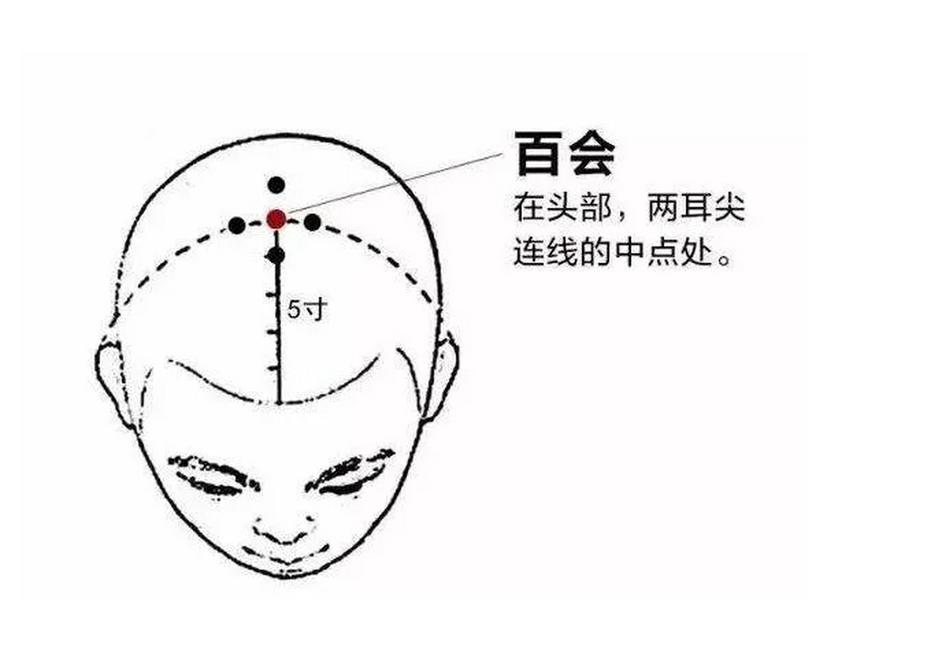 大脑不灵活迟钝两个穴位改善脑供血不足,每天只需要五分钟  脑供血不