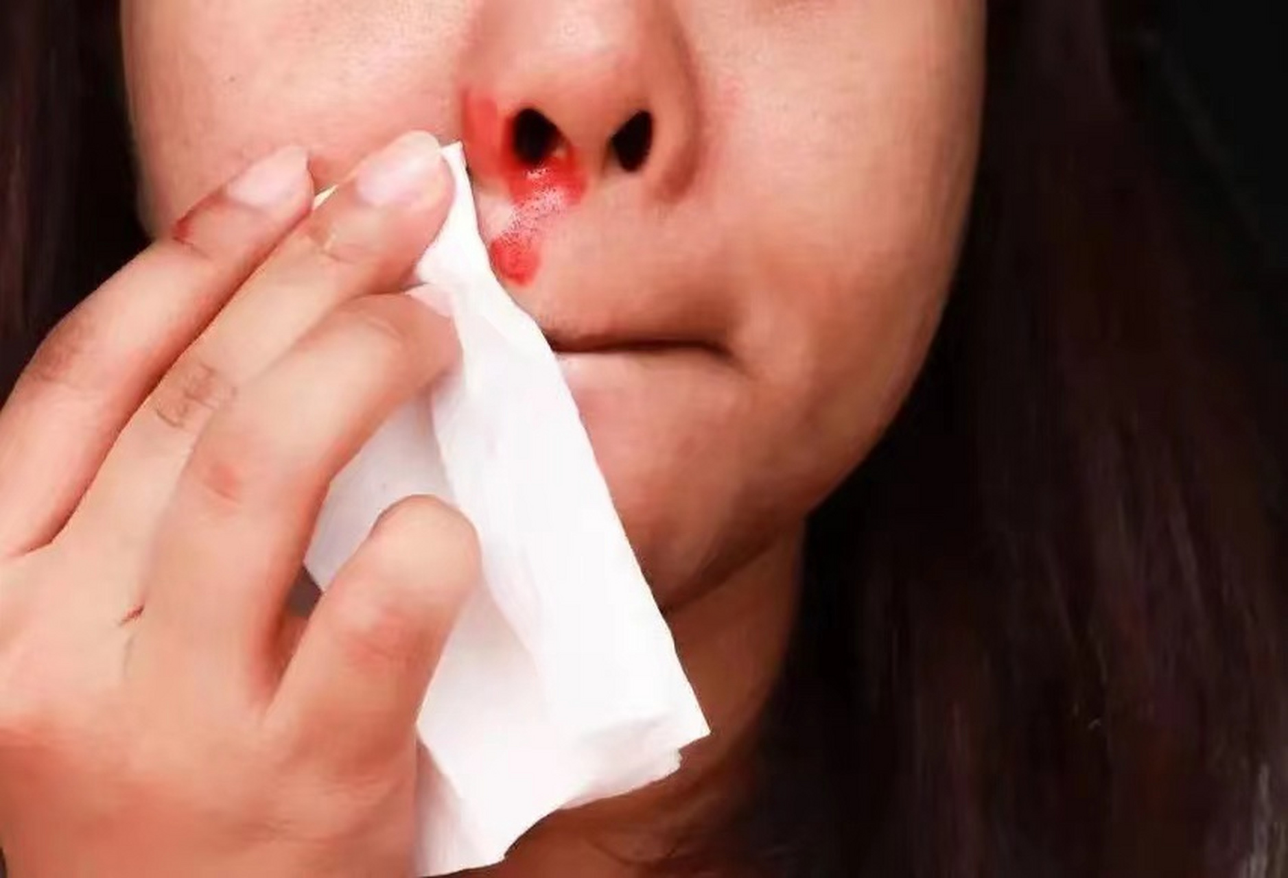 itp偏爱女性,身体出血要警惕!