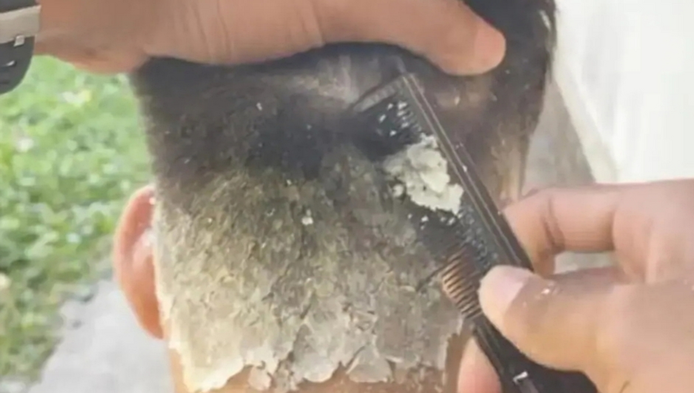 我愿称之为史上最大头皮屑[泪奔]